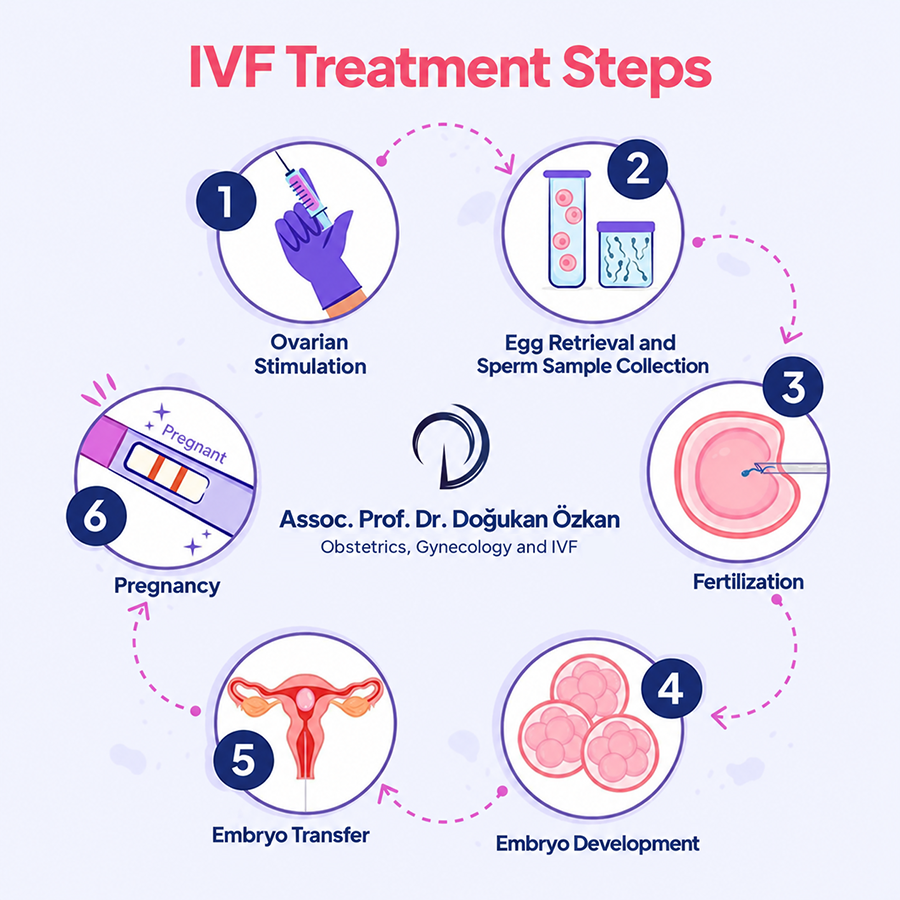 IVF Treatment Steps Infographic