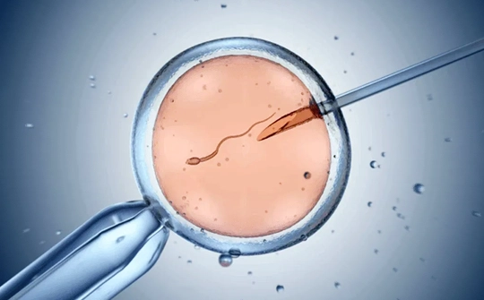 Azospermi ve Sperm Elde Etme: TESE, Mikro-TESE, PESA, MESA, TESA ve ROSI