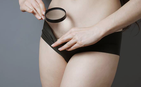 How Do Genital Warts Go Away in Women? Treatment