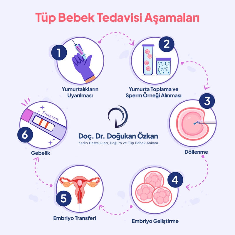 Tüp Bebek Tedavisi Ankara